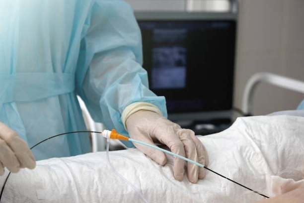 Geste d’ablation par cathéter au bloc, cathéter guidé en main