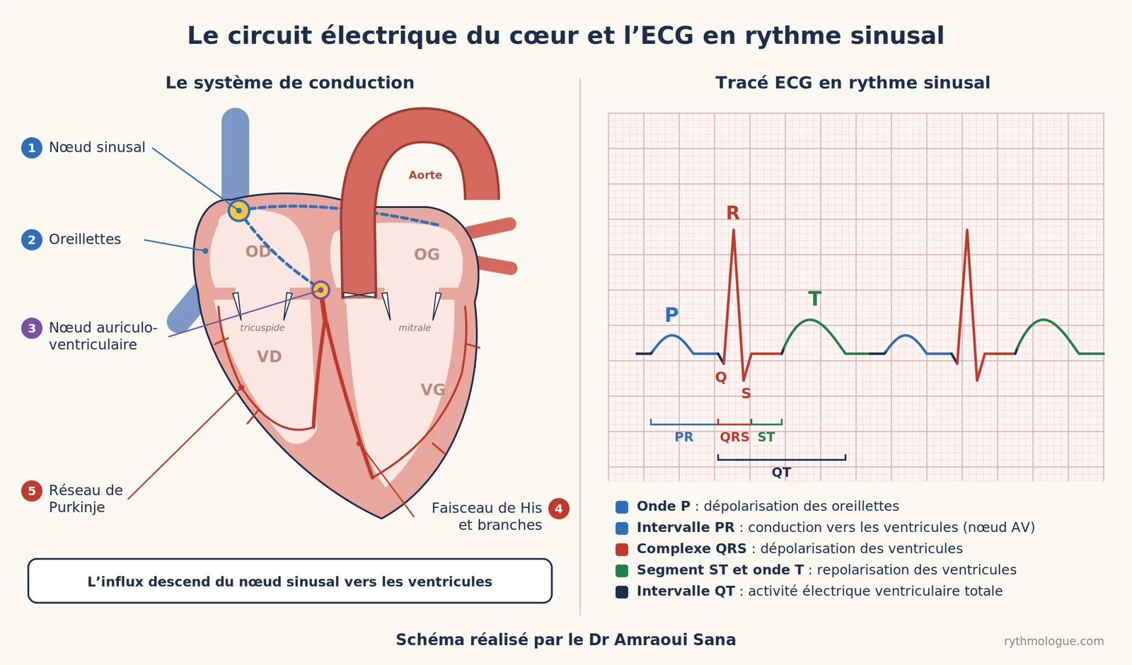Schéma du système de conduction du cœur, du nœud sinusal au réseau de Purkinje, et tracé ECG en rythme sinusal avec les ondes P, QRS et T.