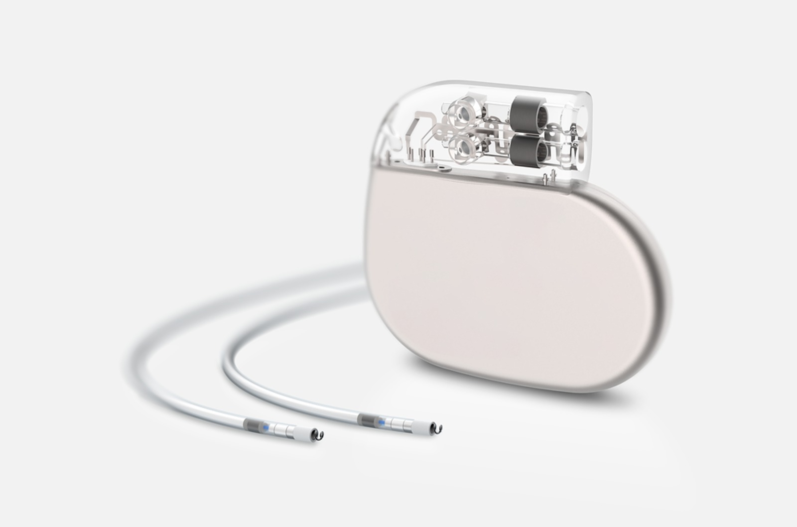 Stimulateur cardiaque (pacemaker)
